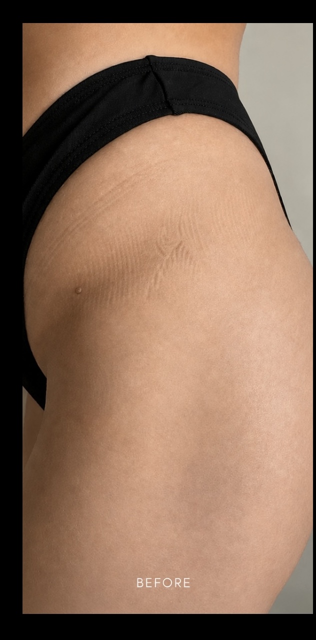Forearm without Brazilian Sun body oil.
